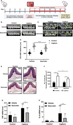 Quercetin Preserves Oral Cavity Health by Mitigating Inflammation and Microbial Dysbiosis